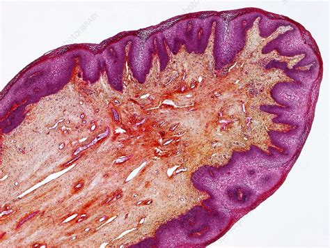 hymen foto|Vulva Bilder Science Photo Library